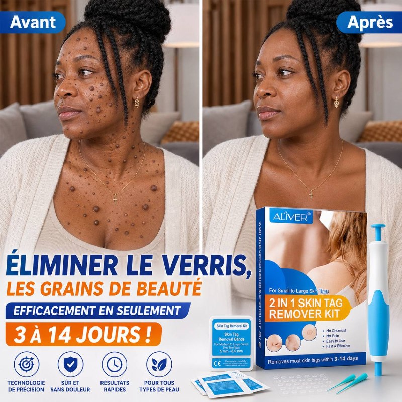 Kit de retrait de verrues et grains de beauté Aliver/ Homme et Femme